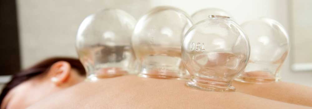 cupping cups along meridian lines of patients back