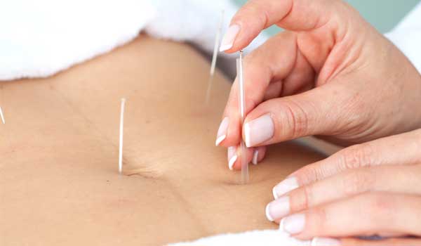 stomach digestive disorders acupuncture needling